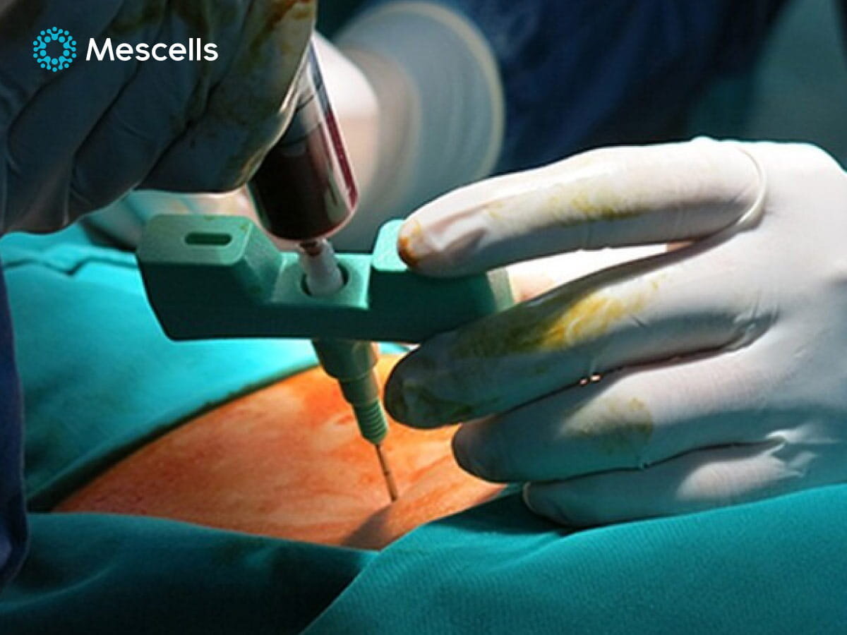 tiem-te-bao-goc-chua-benh