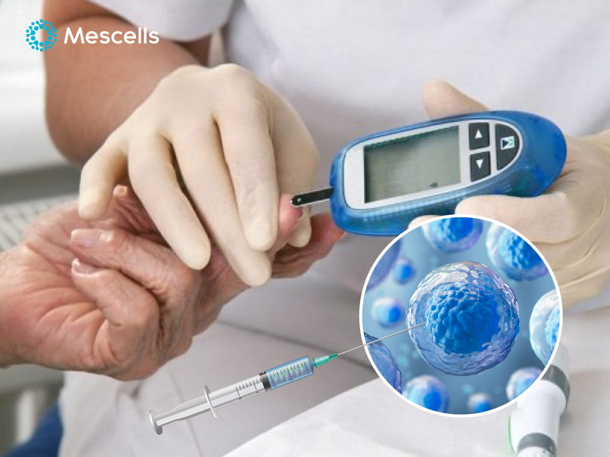 tiem-te-bao-goc-chua-benh-3