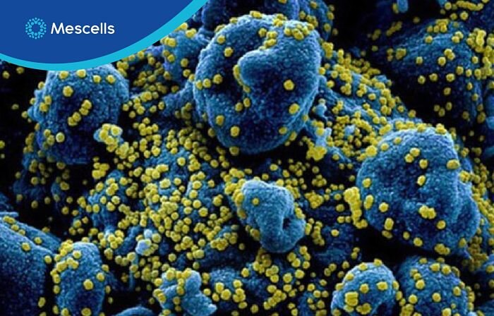 con-bao-cytokine-trong-covid-19-3-1