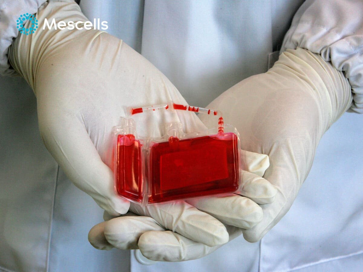 te-bao-goc-mau-cuong-ron-2