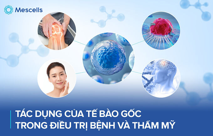 te-bao-goc-chua-duoc-nhung-benh-gi-4