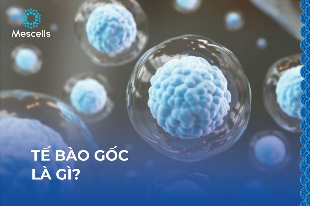 te-bao-goc-la-gi