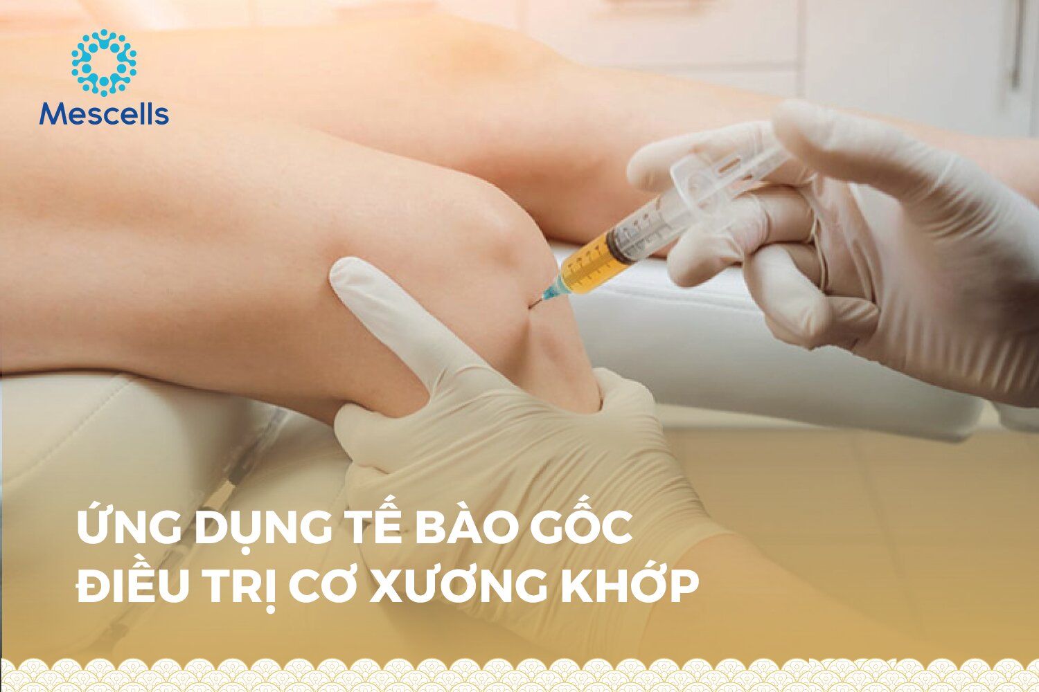 ung-dung-te-bao-goc-trong-dieu-tri-co-xuong-khop