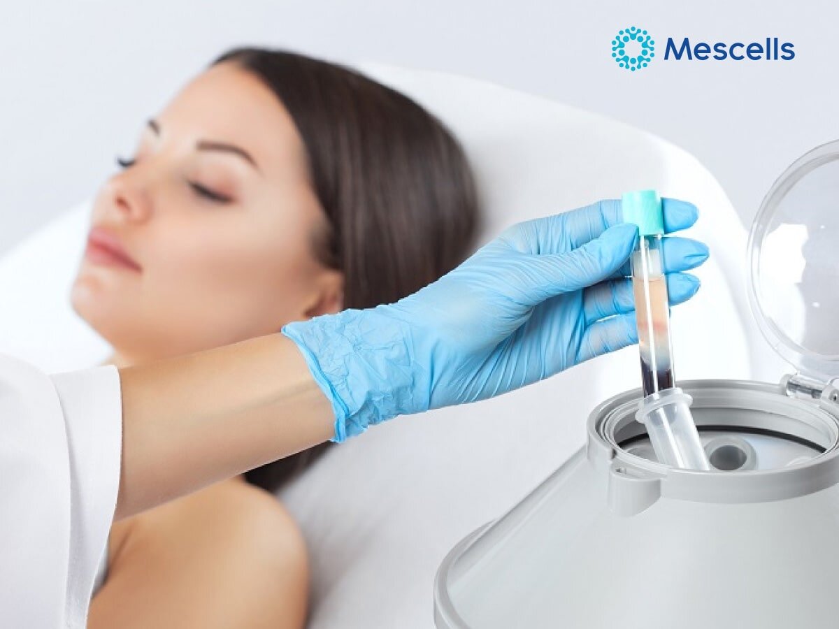 tiem-te-bao-goc-de-hoi-xuan-2