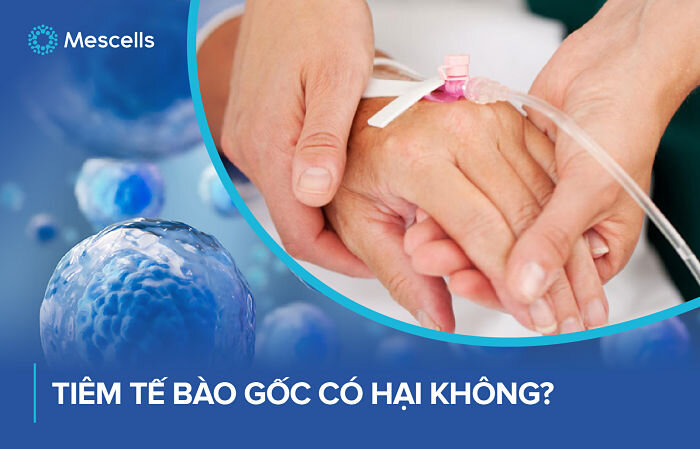 tiem-te-bao-goc-co-hai-khong-1