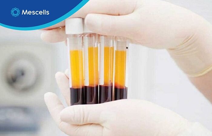 ung-dung-te-bao-goc-va-huyet-tuong-co-chua-khang-the-chong-sarscov2-trong-dieu-tri-covid19-3-1