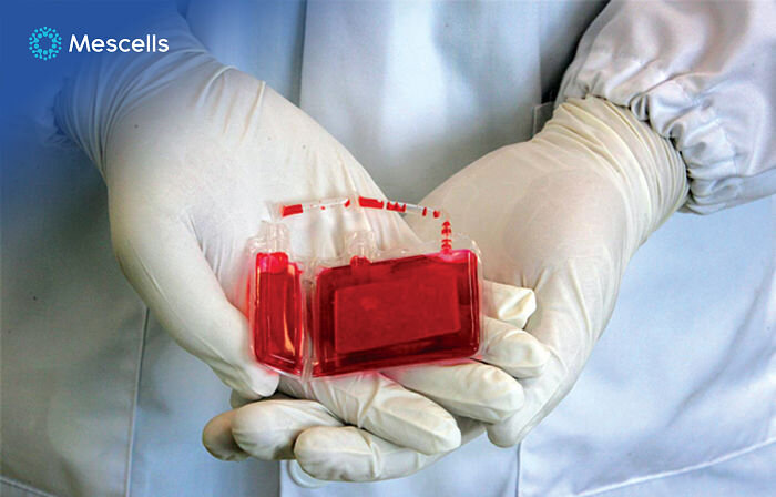 luu-giu-te-bao-goc-day-ron-2